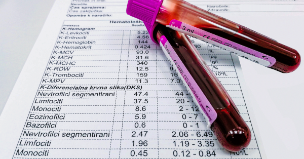 Kri in rekreativni tek